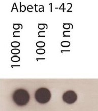 Abeta (1-42) | Amyloid-beta peptide 1-42 in the group Antibodies Human Cell Biology / Neuroscience / Neurodegenerative diseases / Alzheimer's disease at Agrisera AB (Antibodies for research) (AS08 357)